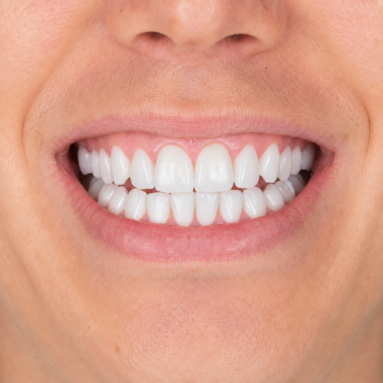 Teeth after dental treatment